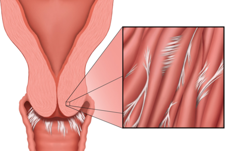 Pictures Of Sexual Penetration 118