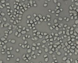post fluoroquinolone -Glabrata