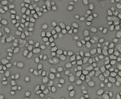 post fluoroquinolone -Glabrata