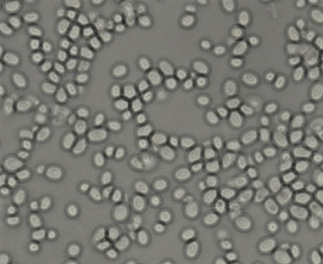 post fluoroquinolone -Glabrata