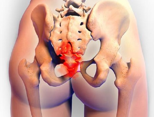 tailbone injury