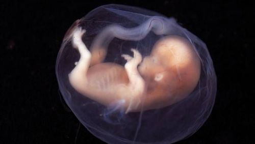 endometriosis in fetus