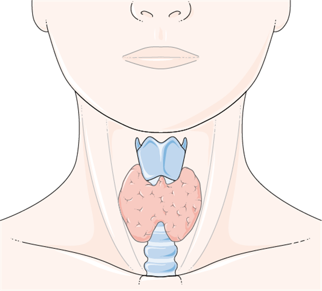 thyroid antibodies