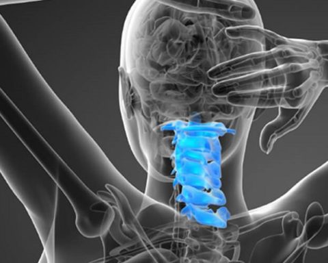 craniocervical instability