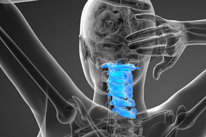 craniocervical instability